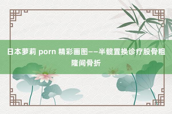 日本萝莉 porn 精彩画图——半髋置换诊疗股骨粗隆间骨折